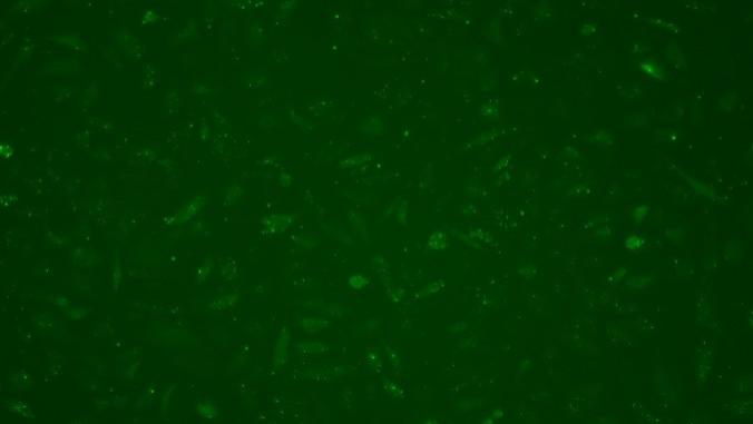 如何高效进行Huvec内皮细胞的siRNA转染？