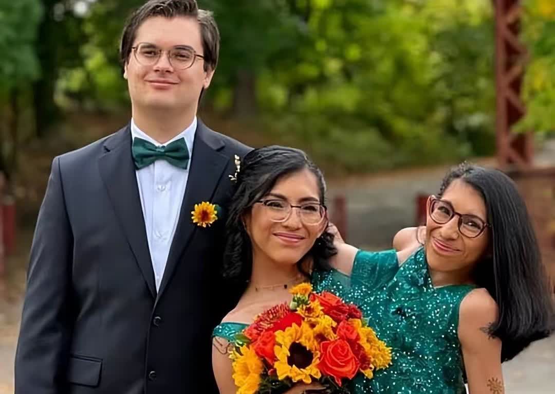 美国一对共用生殖系统的连体姐妹中的妹妹结婚了！

小姐妹俩的脊柱下半部分相连