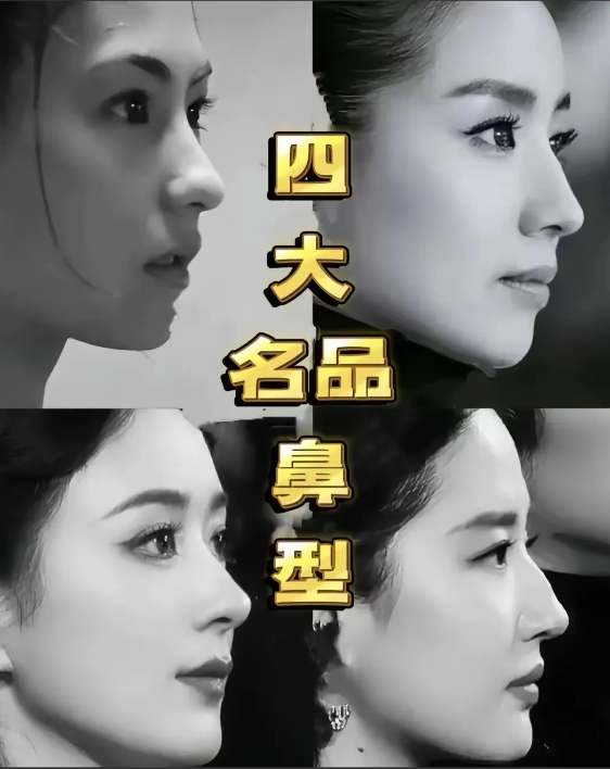娱乐圈四大名品鼻型，各有千秋
 
在美女如云的娱乐圈，明星们的精致五官总是备受关