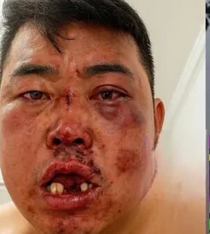 据说此人去蒙古国升国旗，被蒙古人打掉七颗大门牙，真惨！[我想静静]