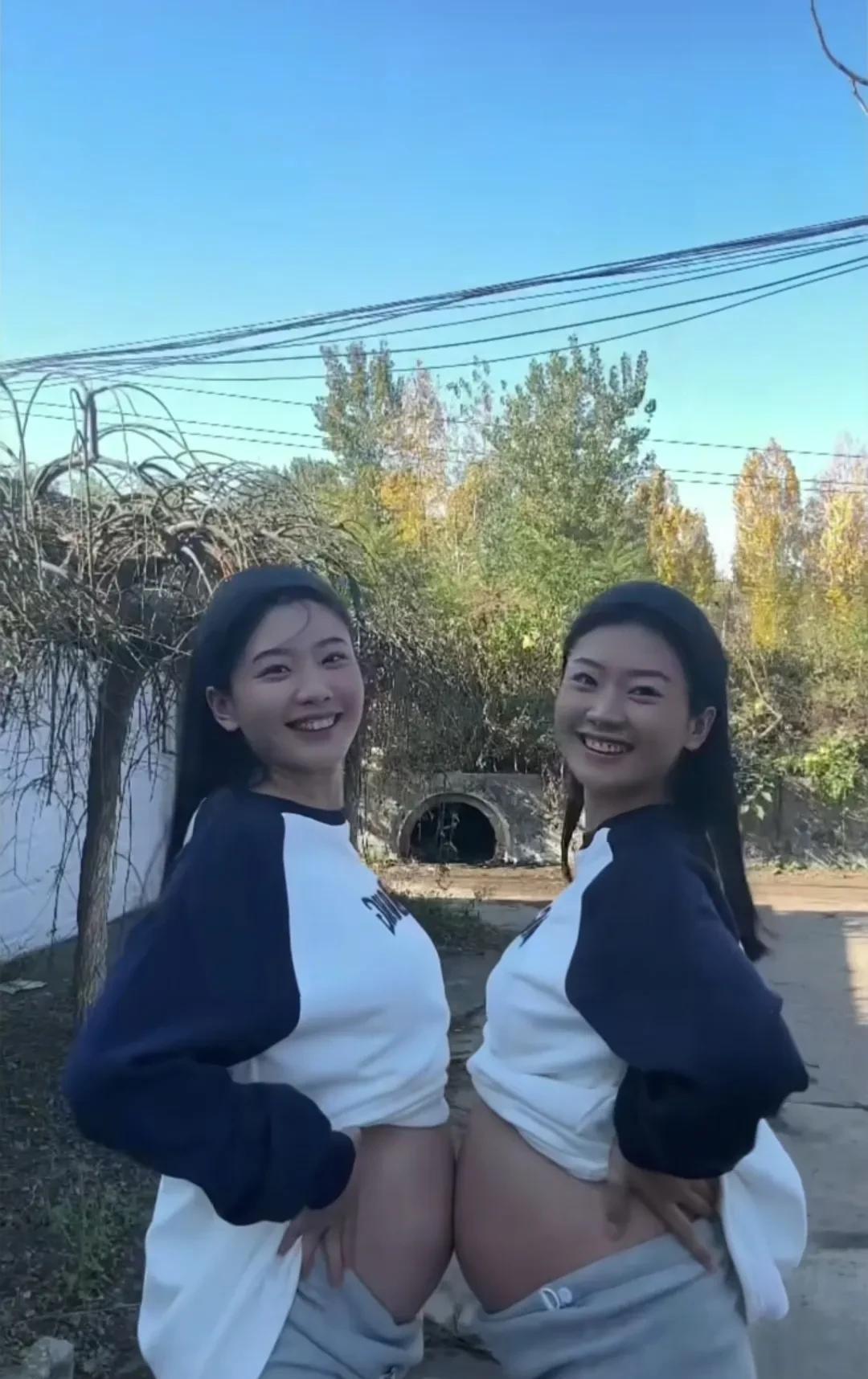 双胞胎同时怀孕，这也是少见[赞]