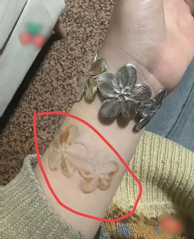 广东，一名女子在网上买了一只手镯，商家信誓旦旦地说这只手镯是不锈钢材质的，于是女