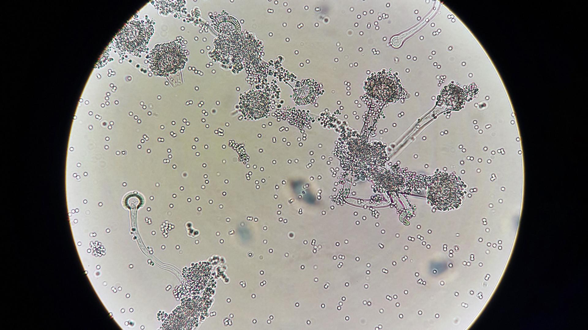 烹饪鸡蛋前一个习惯，大部分人都做错了，会让你摄入很多细菌！