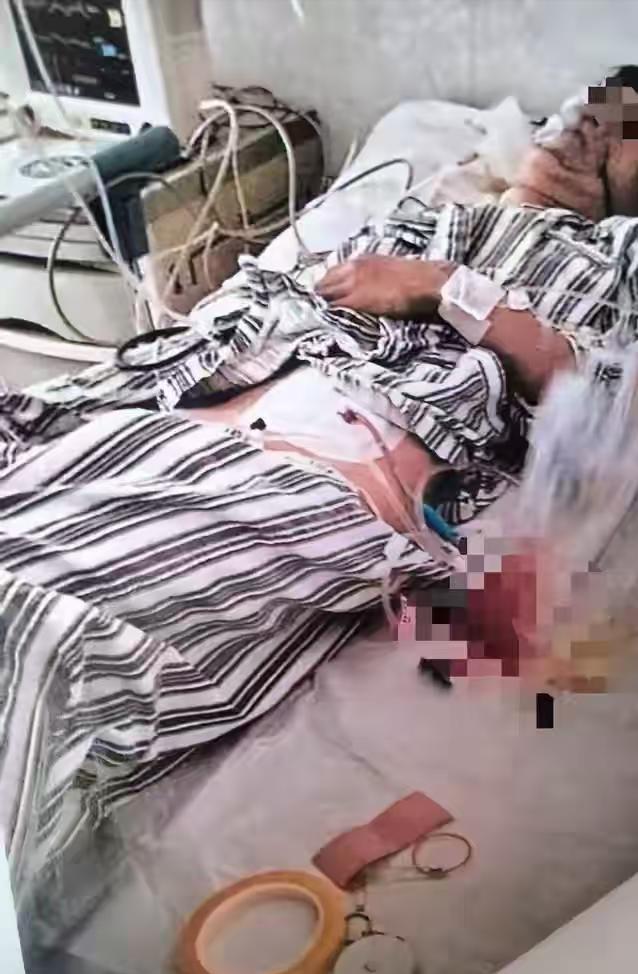 没天理了！云南禄丰，同学叫15岁男孩出去玩，男孩害怕对方打架闹事，就没有去赴约，