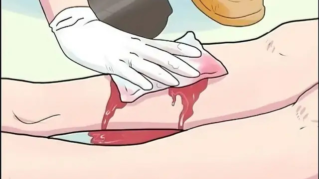 哈尔滨街头男子静脉曲张血管破裂出血？牢记“5字真言”，危急时刻保平安！