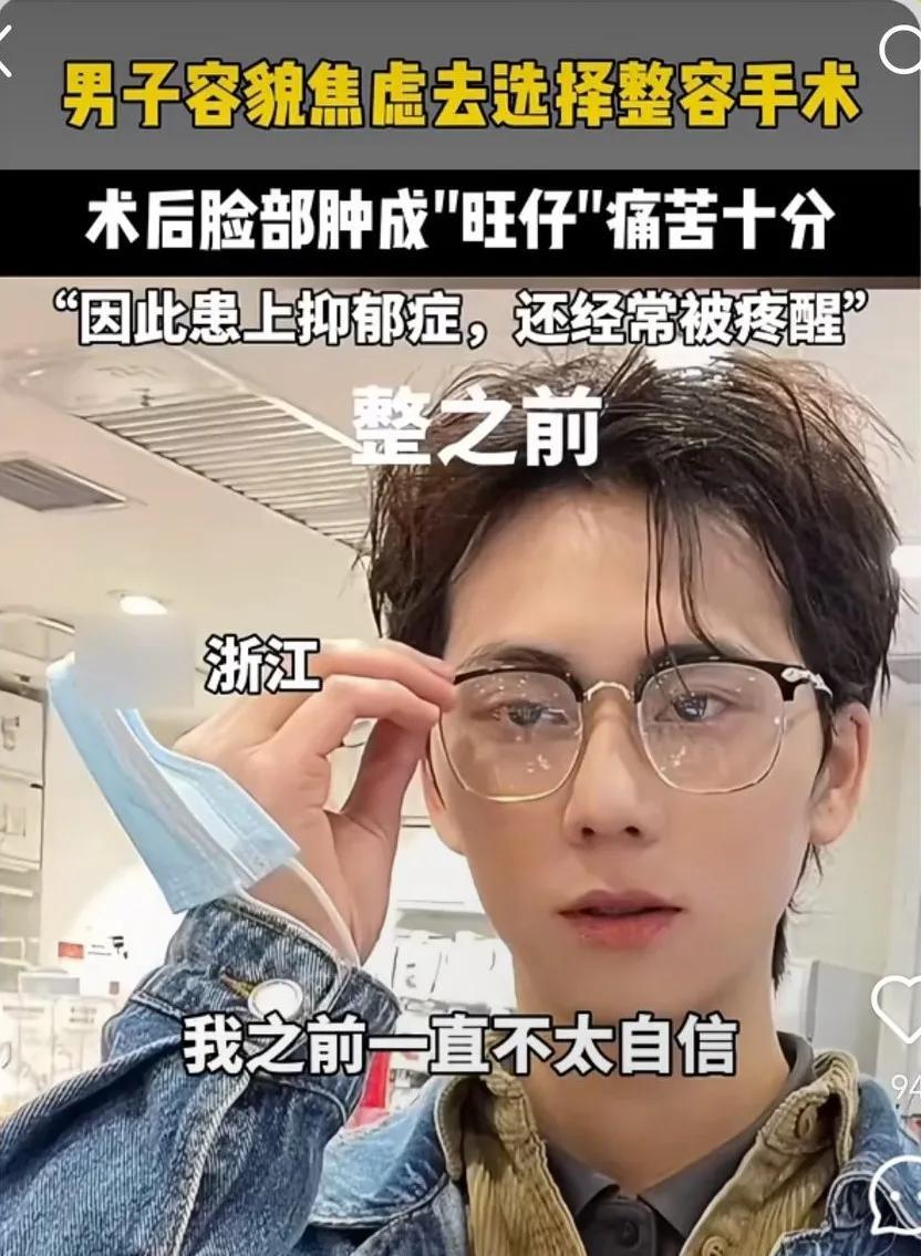 帅哥有容貌焦虑？！整成“旺仔”后，追悔不及。
整之前颜值堪比影视明星，额头、双眼