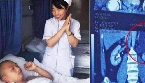 “我的丈夫有4个肾，他力气特别大！”2016年，贵州一男子精力旺盛、天生神力，白