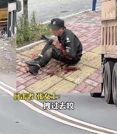 这也太吓人了！保安被恶犬扑倒，手臂被咬得稀巴烂！  撕裂的伤口触目惊心，血肉模糊