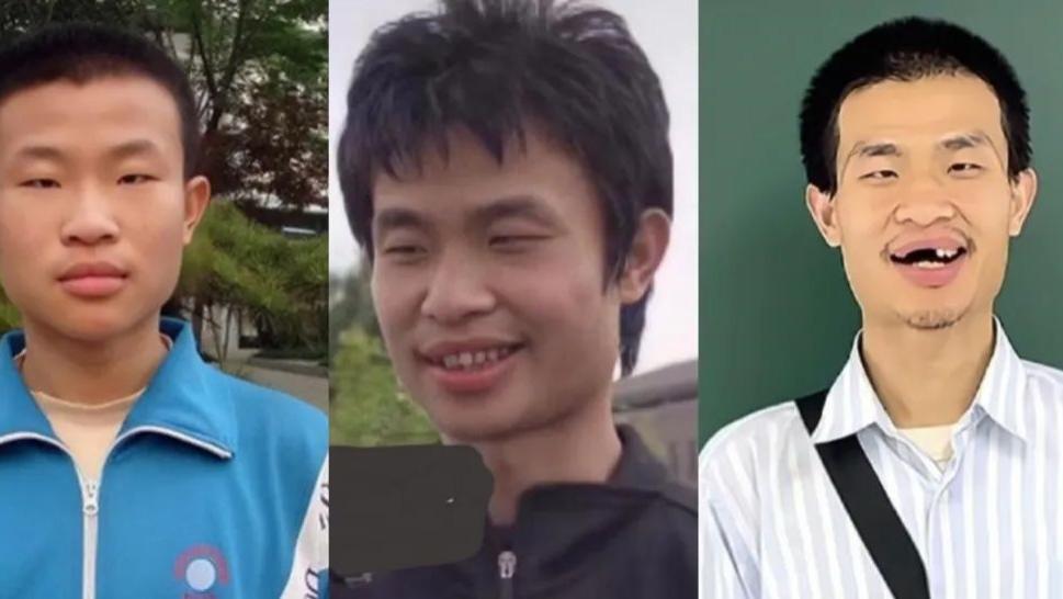 韦东奕的现状，令人担忧