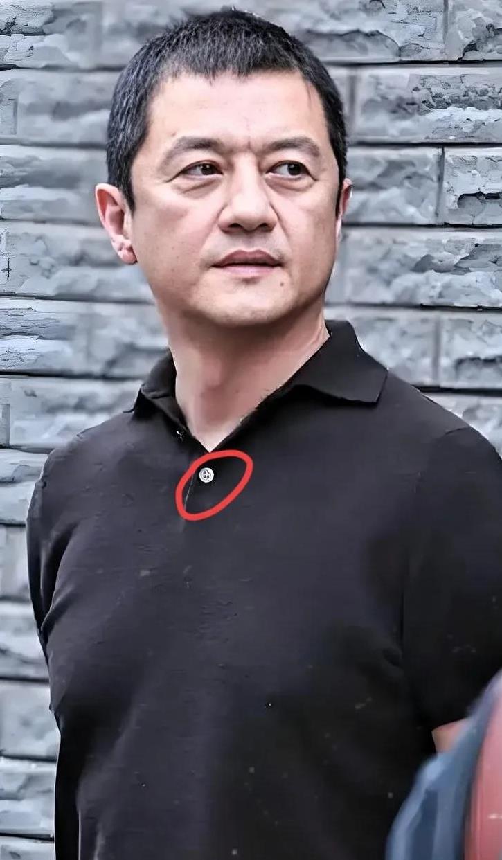李亚鹏他应该，  
也很苦恼吧！  
一边是十多年债务缠身，
一边是健康堪忧拄拐