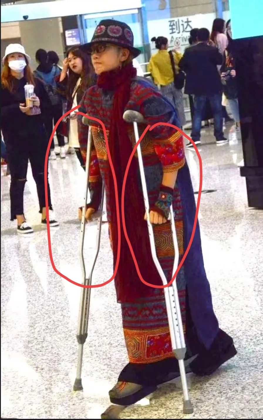 天啊！杨丽萍可真是个奇特的存在啊！
瞧瞧她的近况！
真的有些吓人呢！
出行都得靠