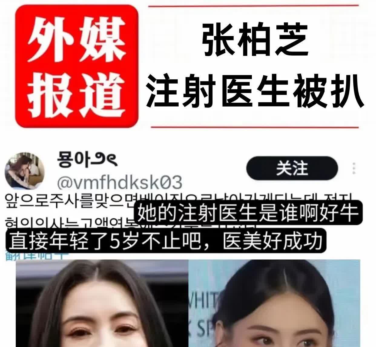 酸了，张柏芝重返青春！
有钱真好，
有钱就可以青春不老，
没钱只能自然老去