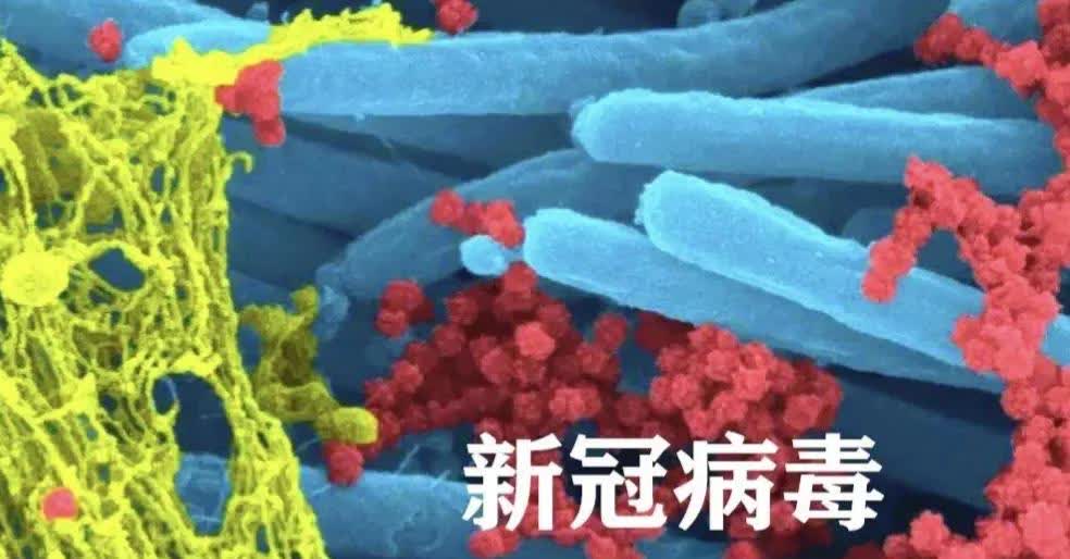 新冠疫情才过去几年，新冠病毒的病原体（零号病人）有可能是参加军运会的美国运动员，