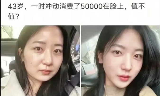 其实原装的才最好看吧，一旦走上医美不归路，就停不下来了。
