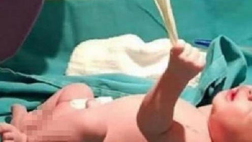 当“最猛新生儿”带着脐带想冲刺，医生差点没抓住，10后这是要整顿产房啊！