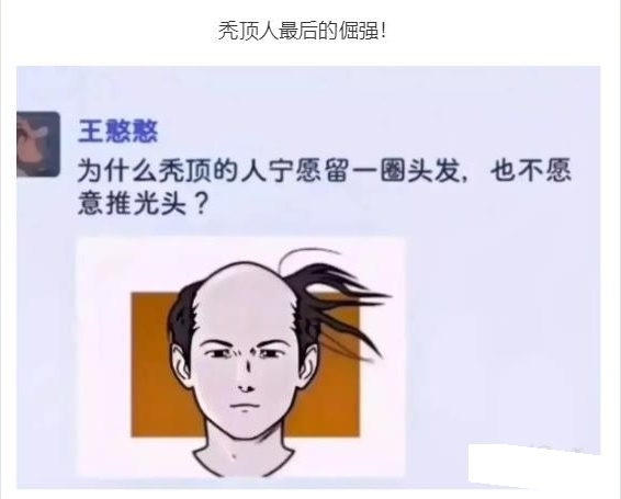 秃顶人最后的倔强