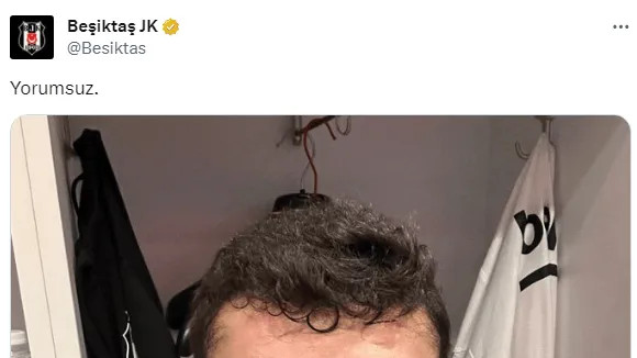 奥波库带伤奇迹逆袭，加拉塔萨雷质疑