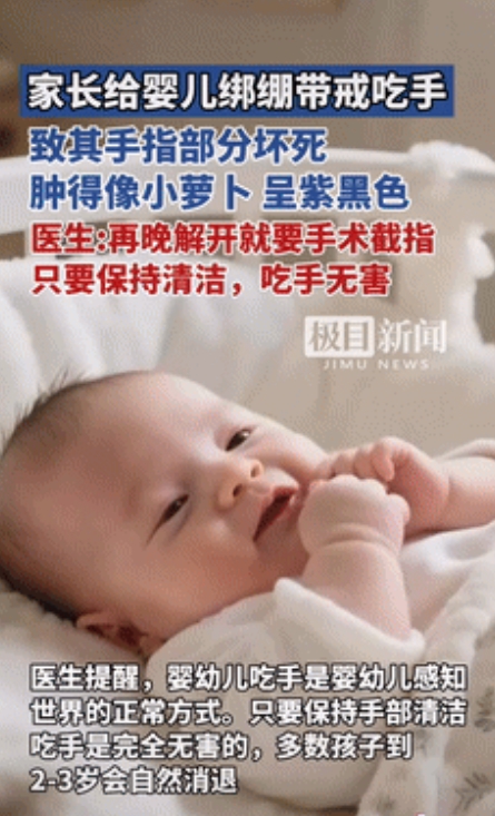 无知惹得祸！湖南一女婴因喜欢吃手指，家长认为不卫生，就用弹力带绑住她的右手，可没