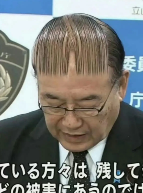 
头发：我就这么几根，你还要我守这么大块儿阵地