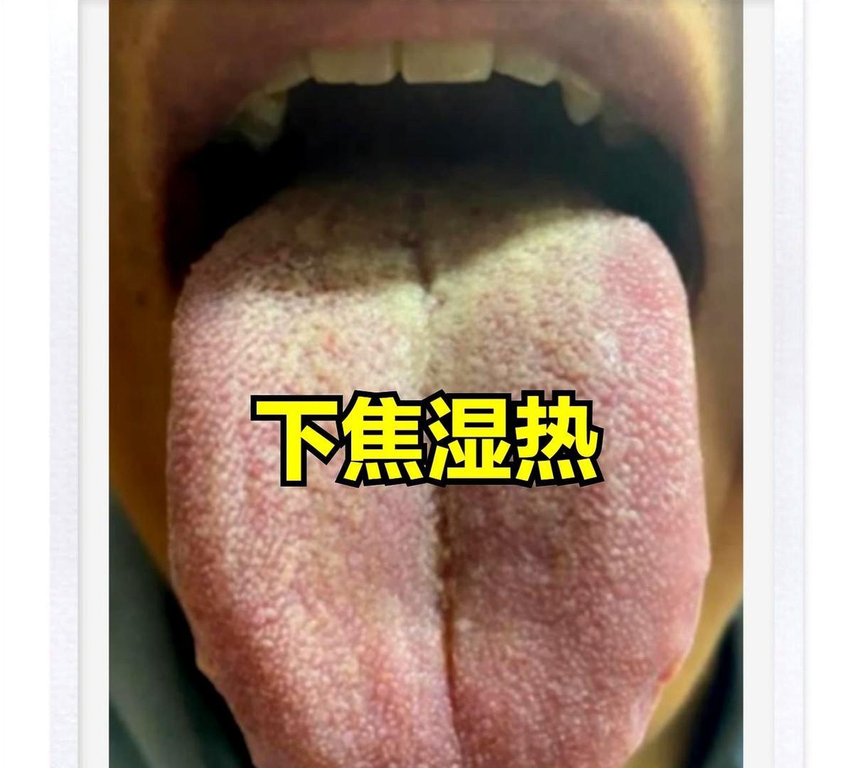 下焦湿热与湿热下注：同是湿热，根源治法大不同！
你知道吗？
身体的小毛病其实都藏
