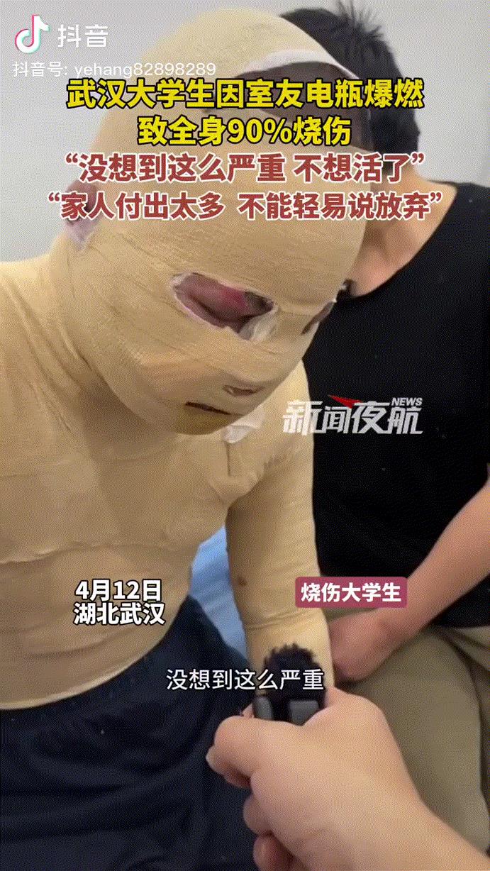 “没想到这么严重，不想活了！”湖北武汉，电瓶爆燃致全身90%烧伤的大学生首发声，