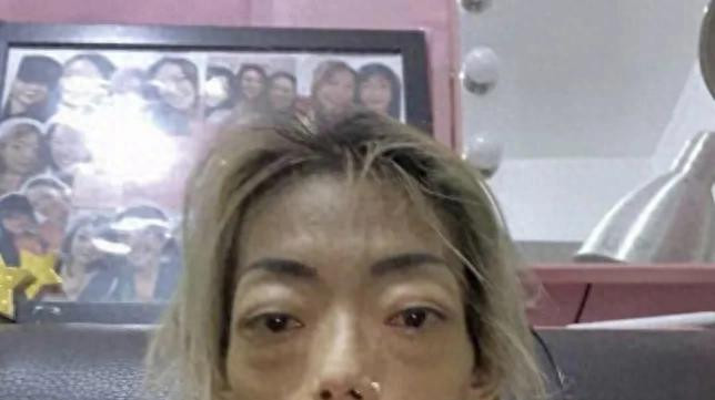 一代女神沦为豪门玩物：结婚8年牙齿全掉，器官切除，面似骷髅