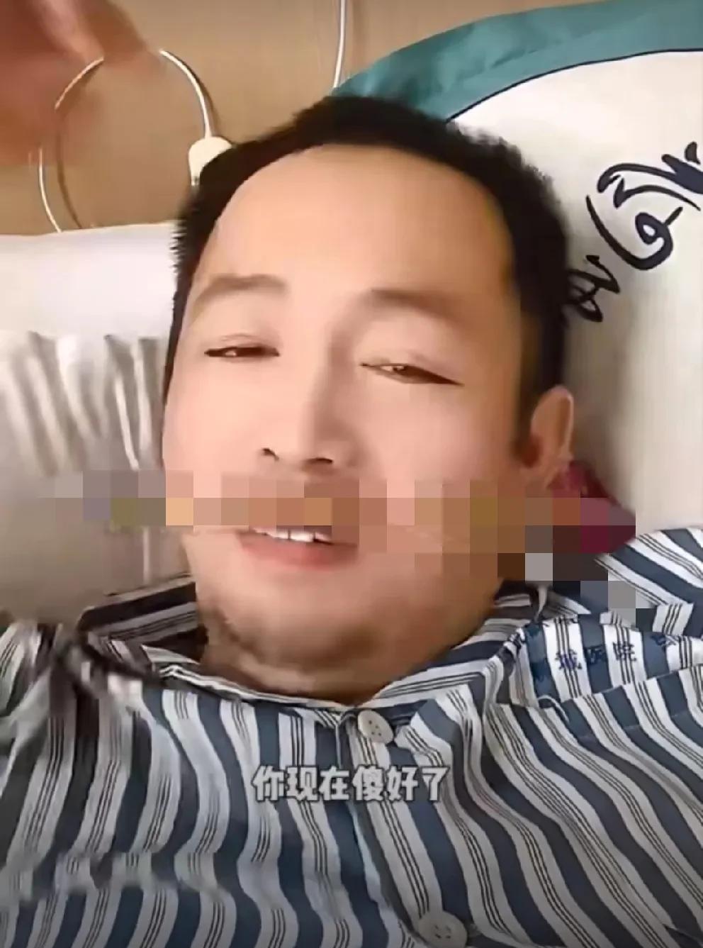 吴迪大哥断指重接后又感染做手术，恐放弃续接！
          吴迪大哥用铡刀