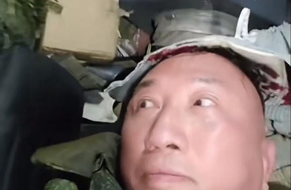 大家的偶像卢宇光头部受伤，卢宇光是位用生命报道战场消息的勇士，几十年来就这样执着