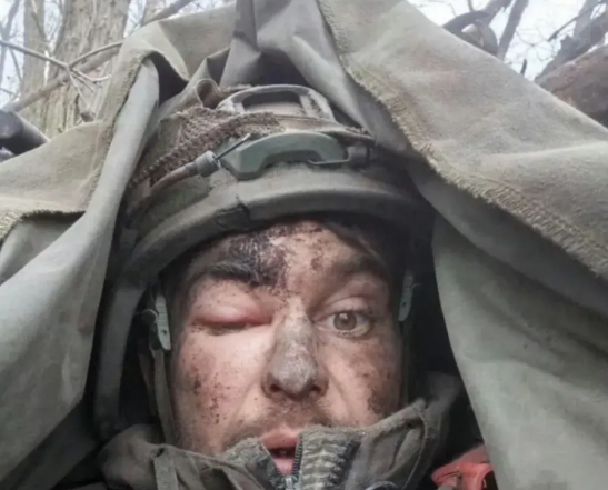 差点把医生吓死！俄乌战场惊现“不死战士”。
一名俄军士兵在库尔斯克战斗时，被一颗