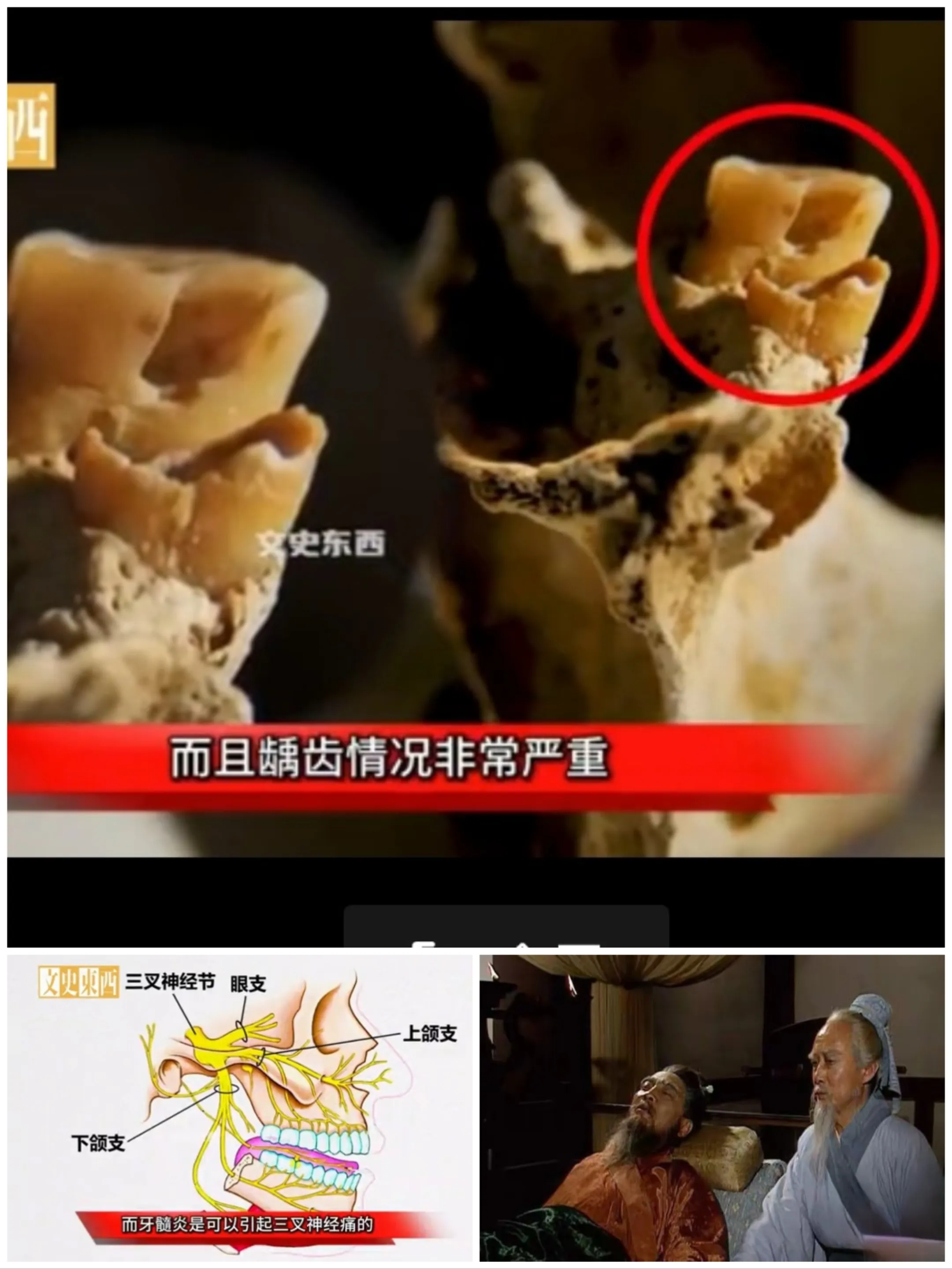 华佗被杀其实也不冤。据说现今考古从曹操的头骨发现，曹操患有严重龋齿，龋齿会导致三