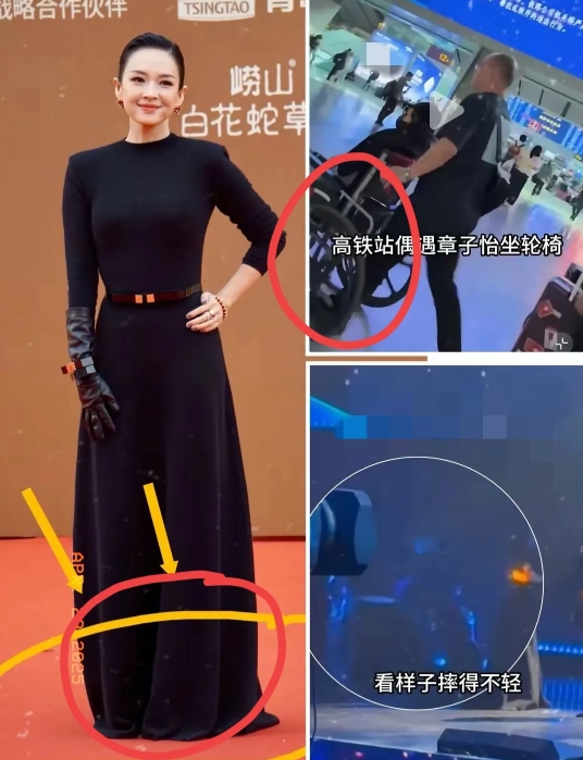 章子怡的事
给大家提了个醒，
别管你身材多好，多漂亮爱美，千万别忘了自己的年纪。