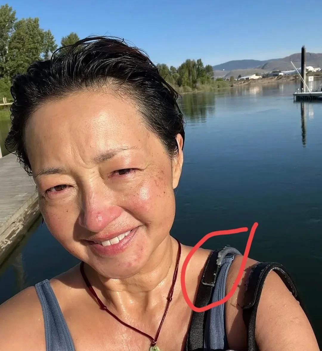 前TVB艺人李绮红晒近况，老年斑，晒伤，是自然老去的样子。
背的包包肩带已经磨破
