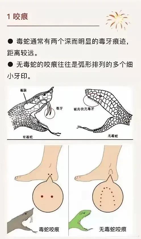 不懂就问，
通过蛇的牙齿咬合痕迹，
来判断它是否具备毒性，
这招靠谱吗？[捂脸]