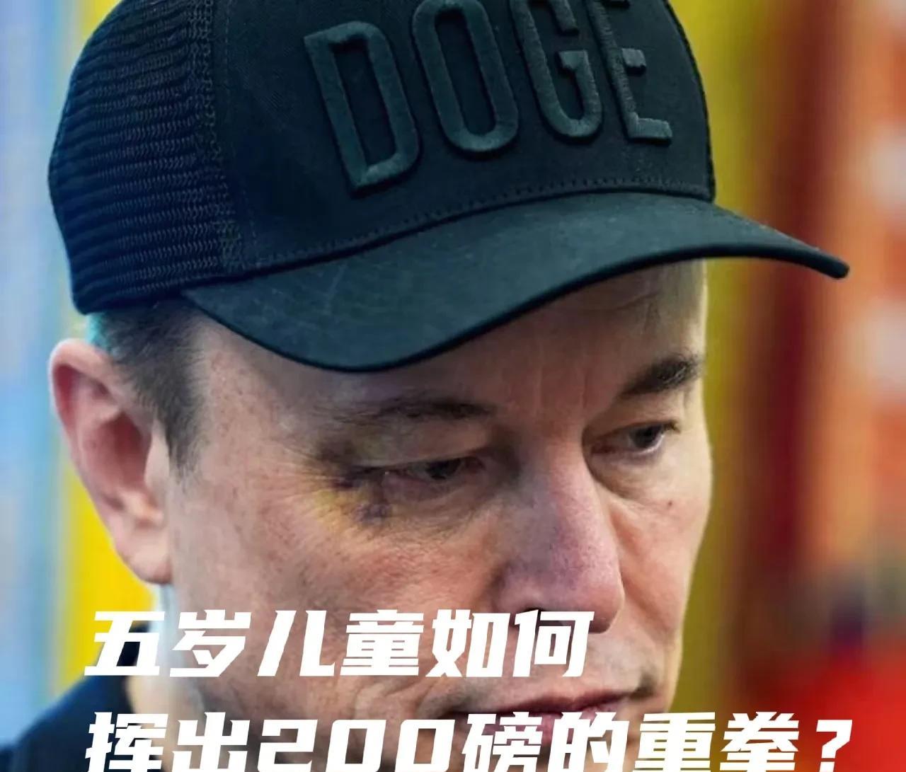 马斯克挨打，却称是五岁儿子不小心误伤。明眼人一看就知道，这眼眶内挨的一拳至少有2