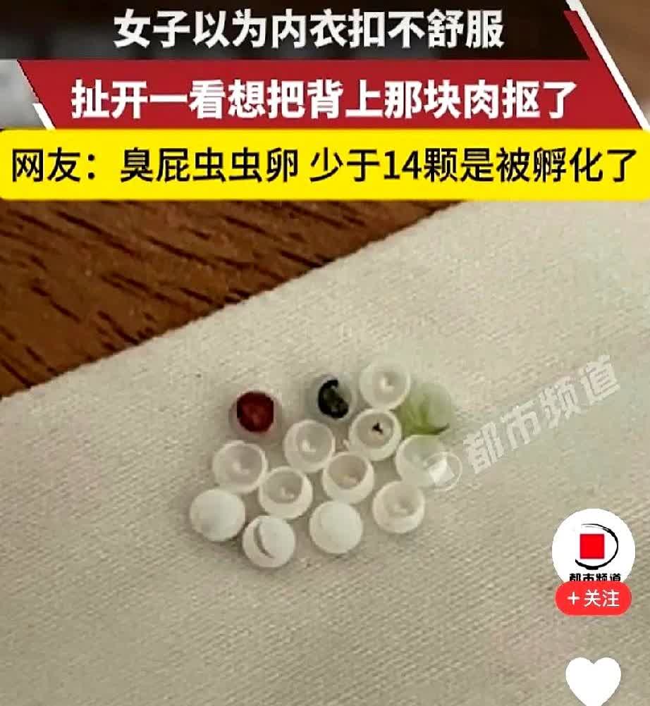 太吓人了！
四川，女子起床穿内衣，结果，却总感觉扣不舒服，她将内衣一把扯开，竟
