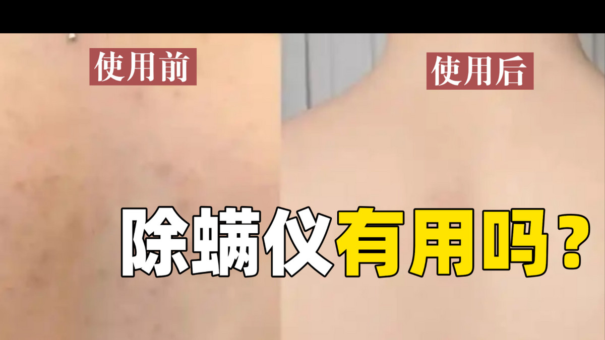 2025除螨仪避坑指南！除螨仪有用吗？2025 年10款机型真相大揭秘！