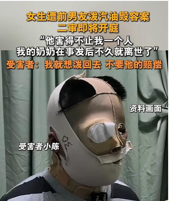 “我不要赔偿，我要泼回去！”湖北恩施，一名女孩被前男友两次泼汽油点火烧伤，容貌尽