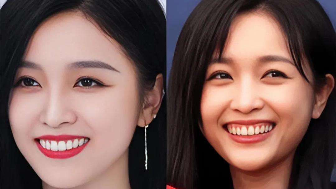 明星白骨胸撞上假牙脸：审美癌变何时休