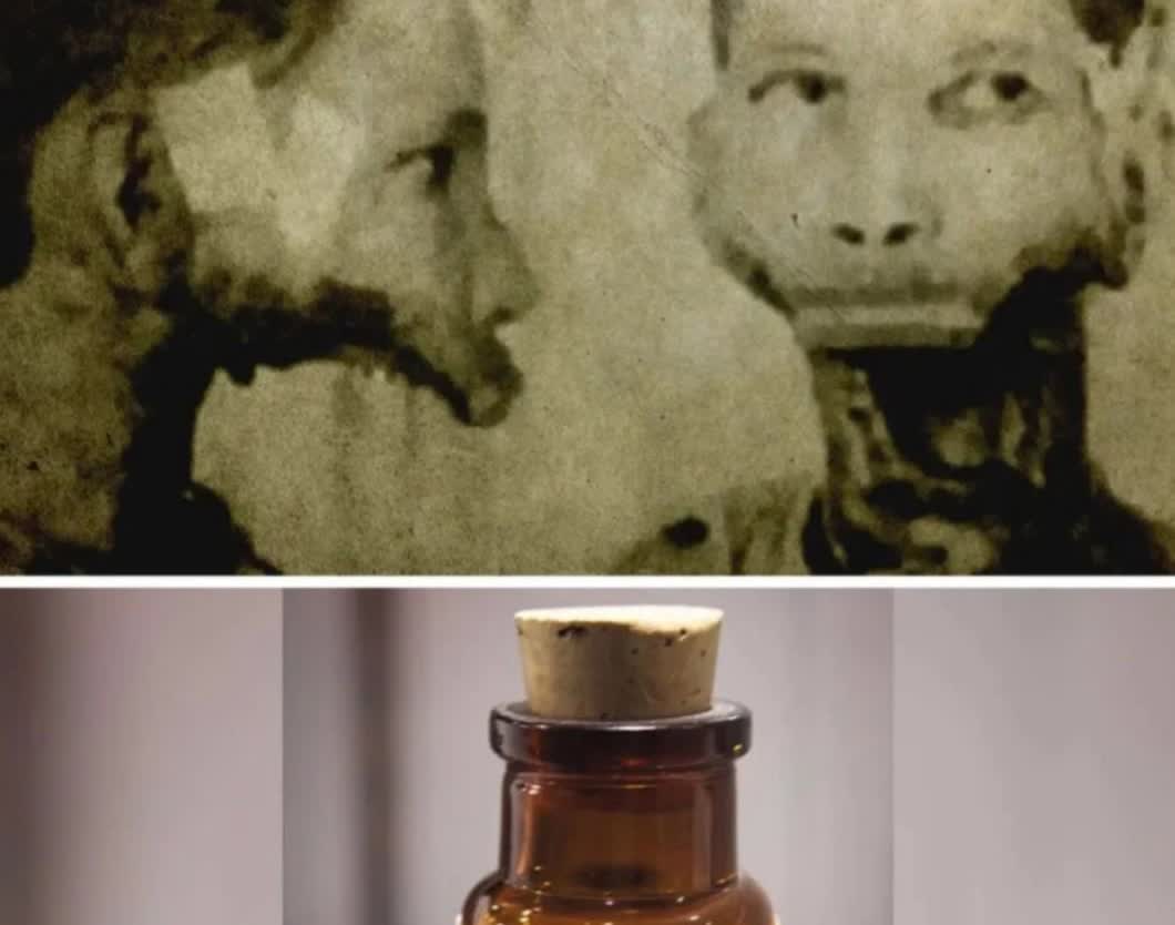 1927年，美国一男子为展现男性雄风，连续4年饮用1400瓶核辐射水，下巴被放射