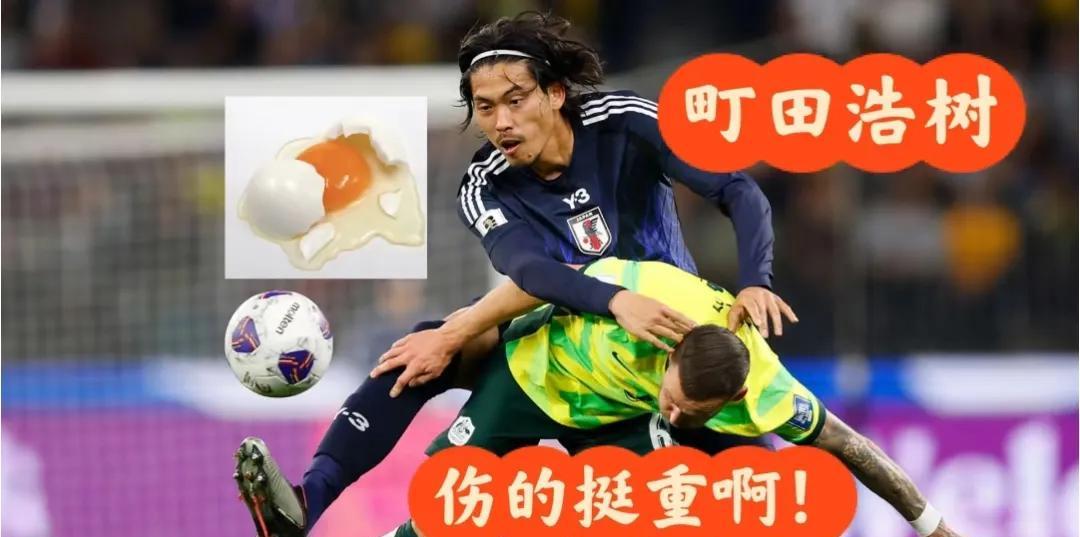 他只有1.6个蛋蛋
他为国踢球残了蛋，让人肃然起敬！
他是日本国脚町田浩树，在亚