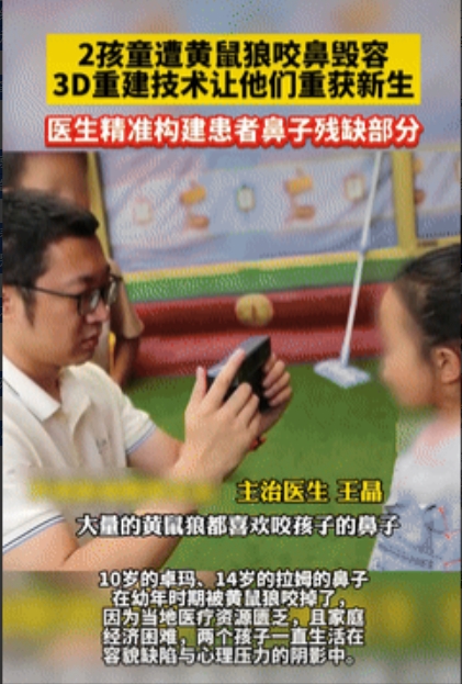 这才是真专家！四川甘孜，2藏族孩童小时候睡觉时，意外被黄鼠狼咬掉鼻子，导致她们一