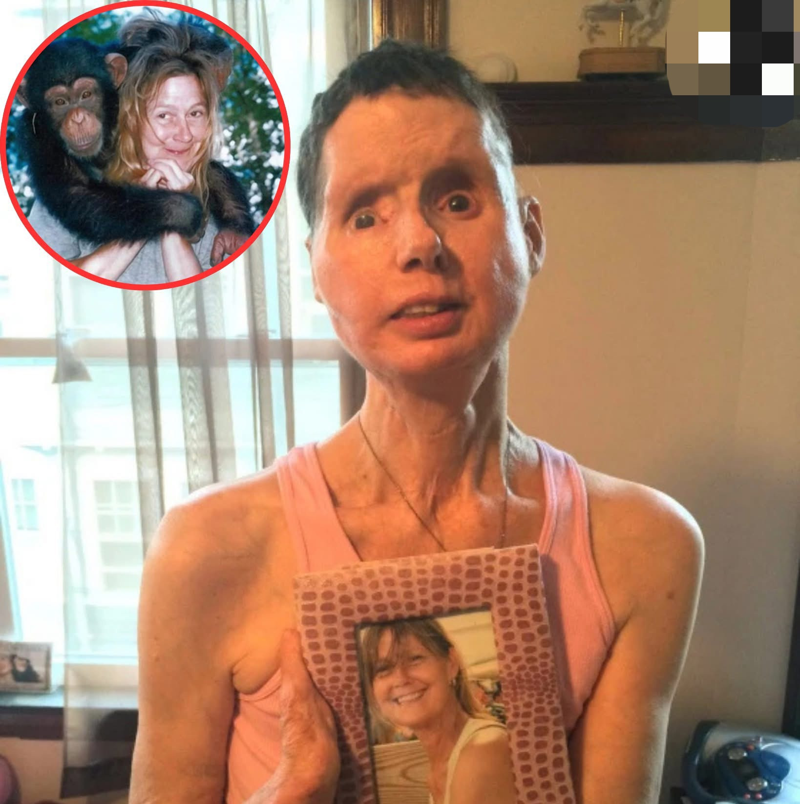 黑猩猩袭击女子毁容











天哪！谁能想到，一只从小当宠物养的黑猩