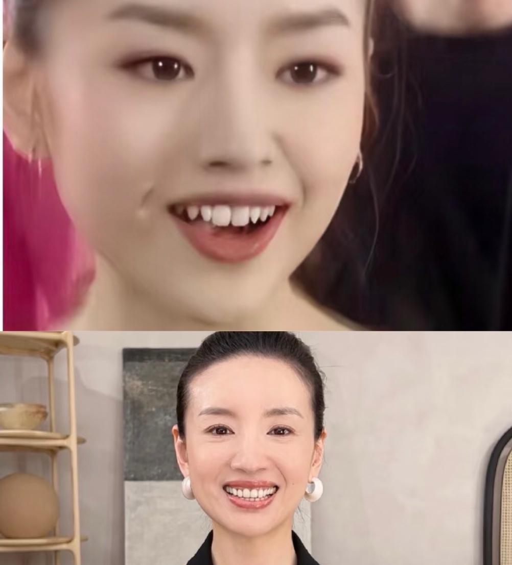 董洁对她的牙齿做了什么，
以前的牙挺灵性呀，
尖尖的牙像小猫咪后来是贴片了吧整齐