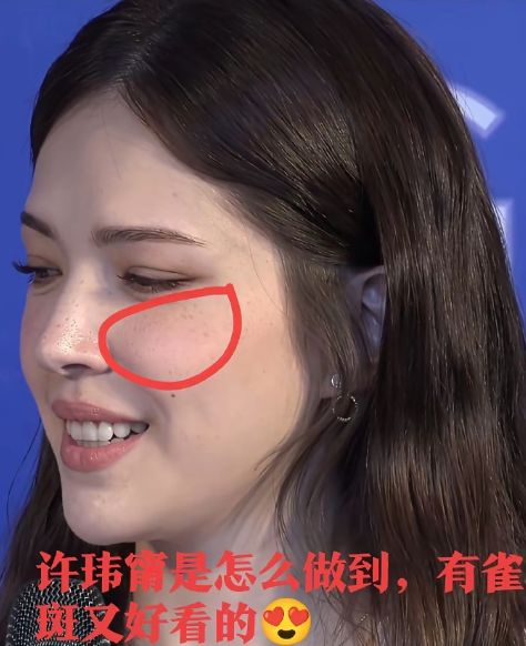 为什么许玮甯一脸雀斑还这么漂亮，她一定很白，长这种斑的人一般都很白！

原来漂亮