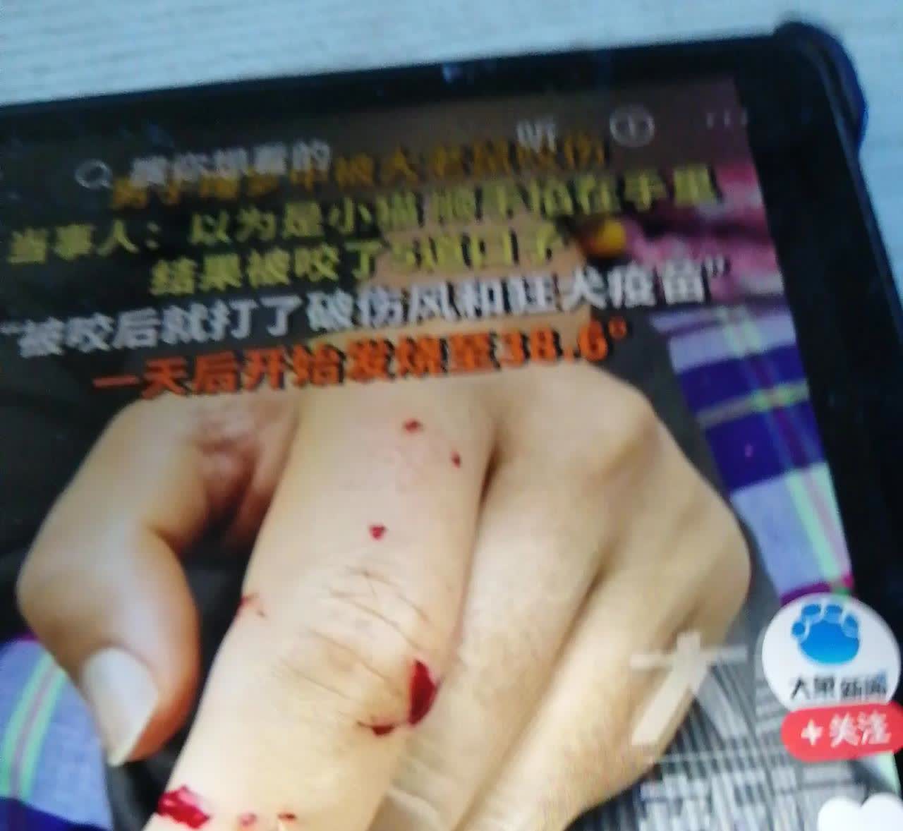 ：不速之客，
睡梦中抓老鼠
江苏抚锡一男子梦中觉得手被咬，梦中一把捏住，痛醒