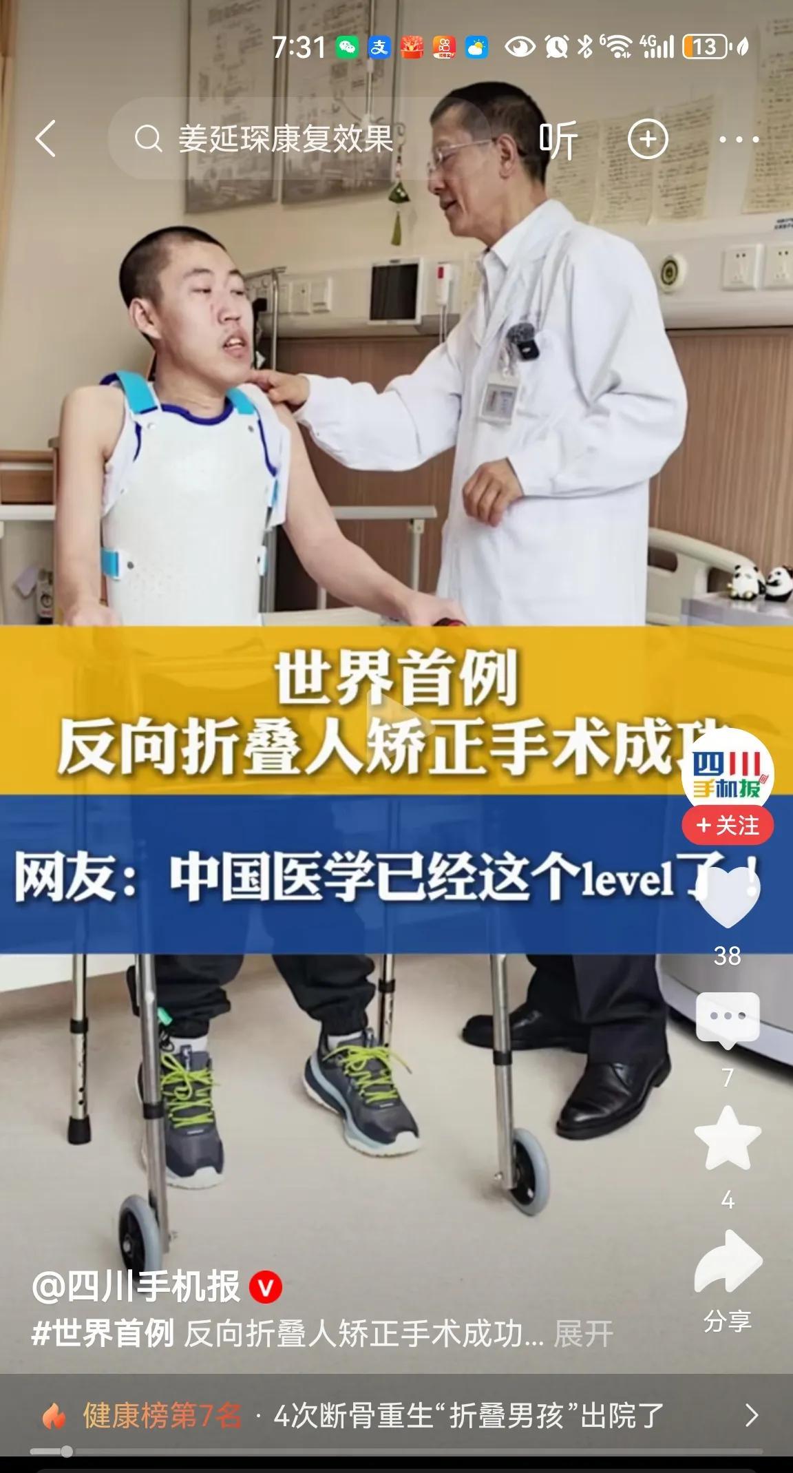 #4次断骨重生“折叠男孩”出院了#
世界医学奇迹，“折叠男孩”终于打开了“折叠人