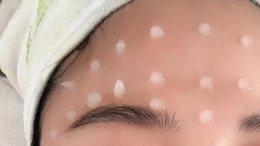 毛孔粗大怎么办？