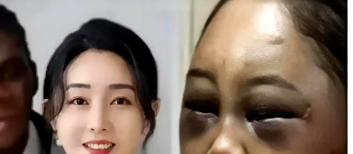 这就是媚外的苦果…

一女子不知道为了所谓的爱情，

还是为了媚外带来的
