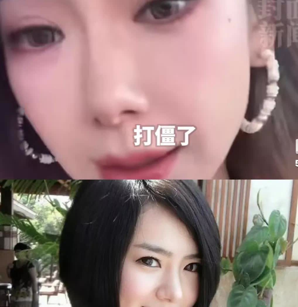 戚薇有钱，我不羡慕
戚薇老公愿意主内，我也不羡慕
可看见戚薇说她打肉毒打僵了