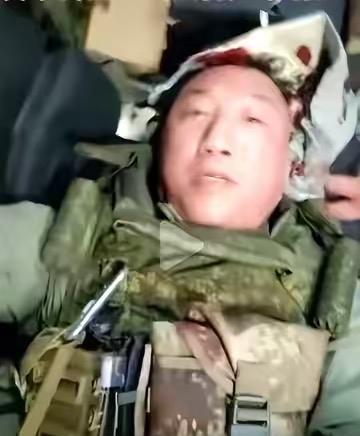 战地记者卢宇光在俄乌冲突前线受伤了，据说是遭到乌克兰无人机的袭击，当战地记者真的